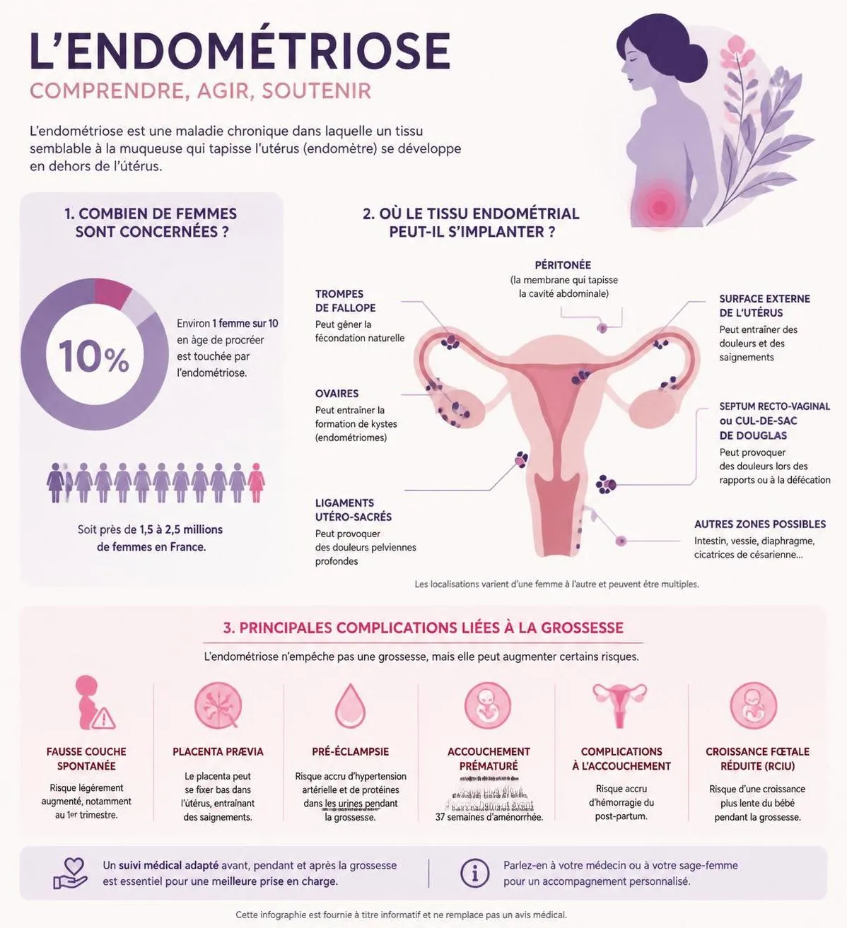 une nouvelle étude révèle un léger accroissement du risque de malformations congénitales chez les femmes atteintes d'endométriose, apportant un éclairage crucial sur cette condition.